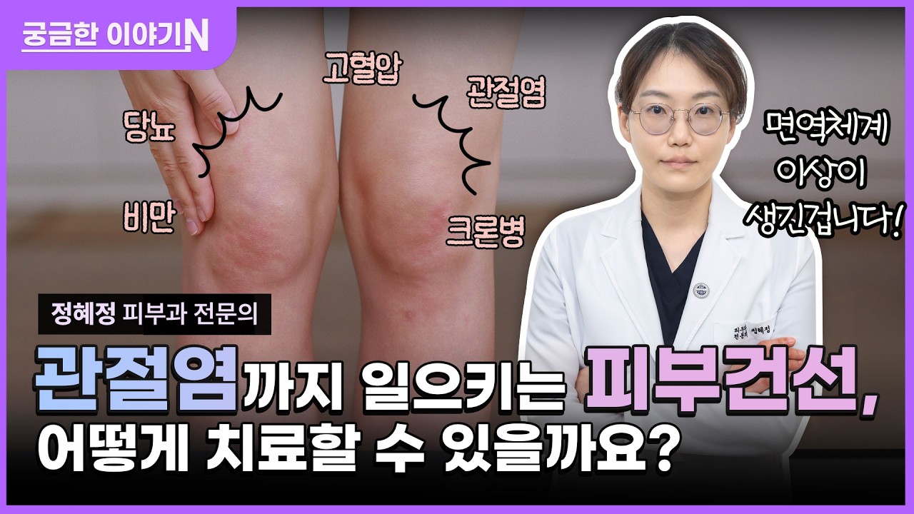  📍건조해서 건선?🤔 [궁금한 이야기N] 보습하면 해결될 것 같았던 건선이 관절염까지⁉️😧 feat. CLOVA Dubbing