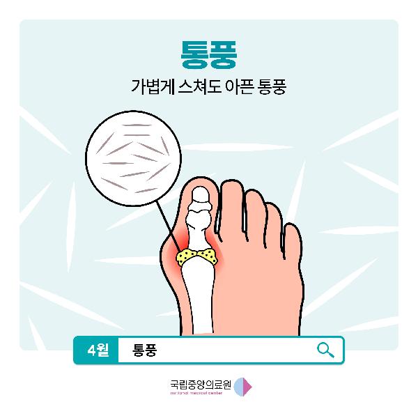 가볍게 스쳐도 아픈 통풍