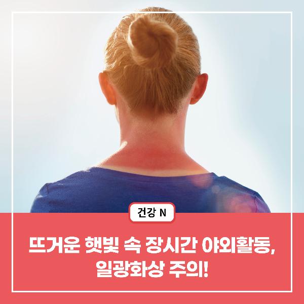 [건강N] 뜨거운 햇빛 속 장시간 야외활동, 일광화상 주의!