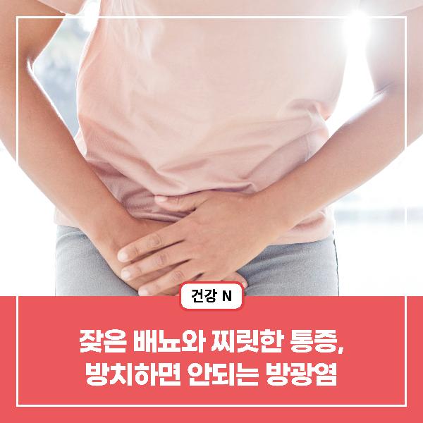 [건강N] 잦은 배뇨와 찌릿한 통증, 방치하면 안되는 방광염