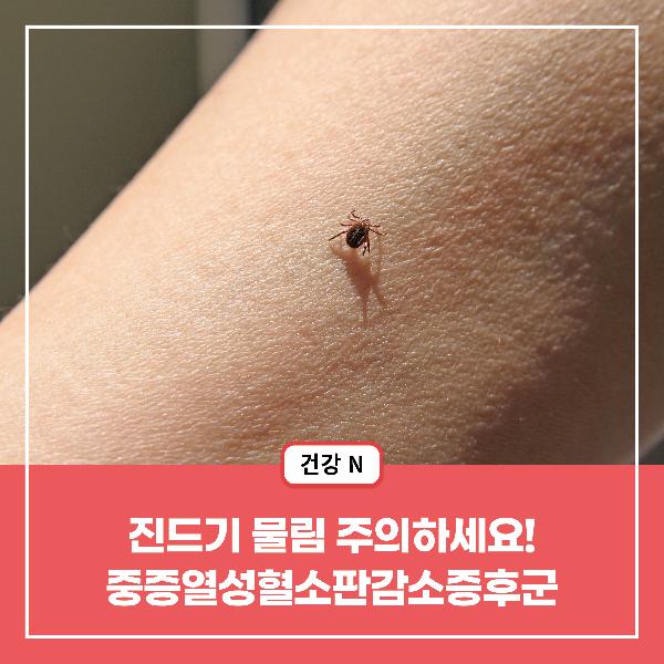 [건강N] 진드기 물림 주의하세요! 중증열성혈소판감소증후군